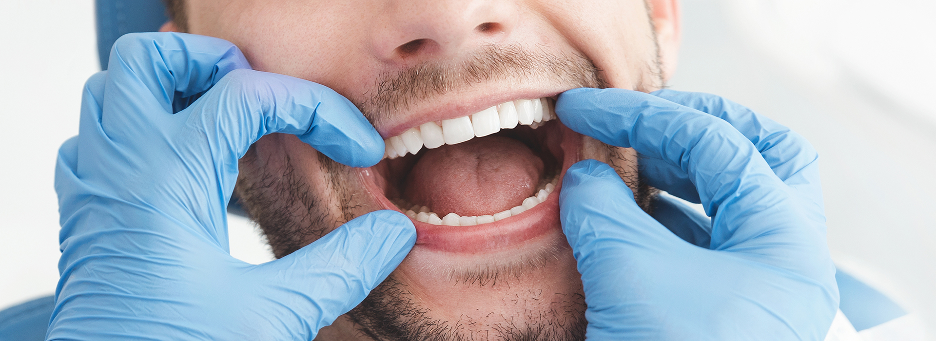 A man in a dental office, holding his mouth open with gloved hands, while wearing a blue surgical gown and mask.